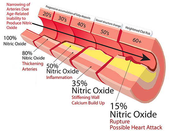 nitric-oxide-graphic.jpg